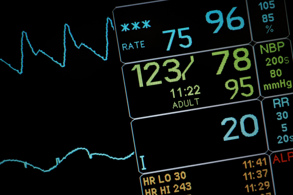 Screen showing patient vitals